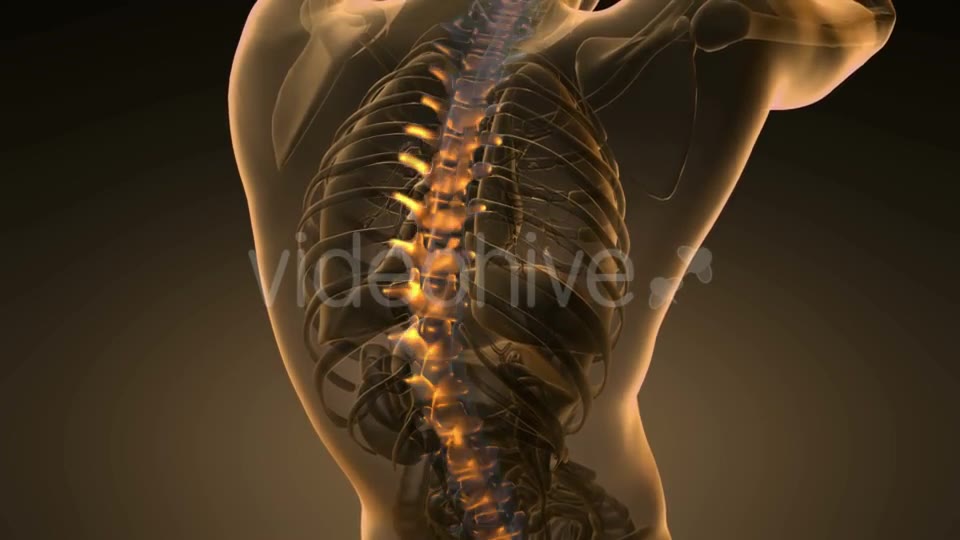 Backache in Back Bones - Download Videohive 20567311