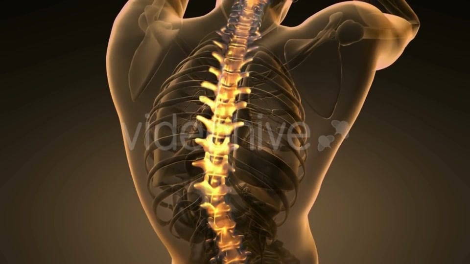 Backache in Back Bones - Download Videohive 20567311