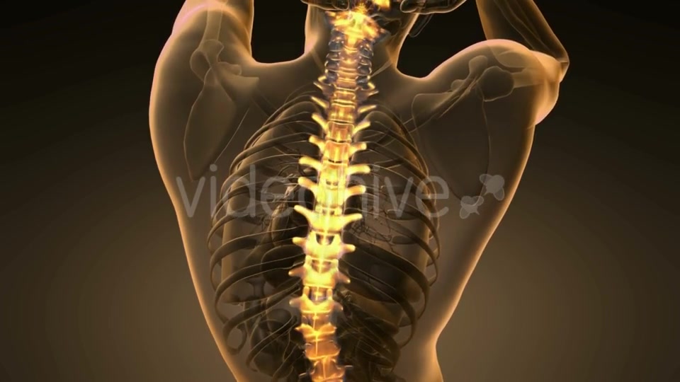 Backache in Back Bones - Download Videohive 20567311
