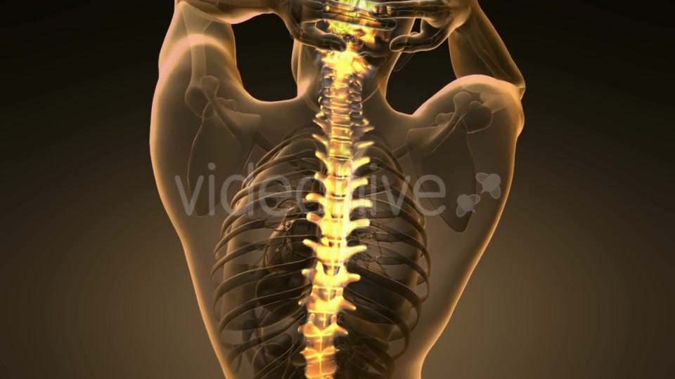 Backache in Back Bones - Download Videohive 20567311