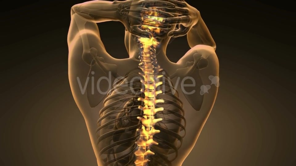 Backache in Back Bones - Download Videohive 20567311