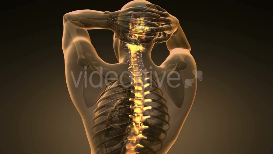 Backache in Back Bones - Download Videohive 20567311