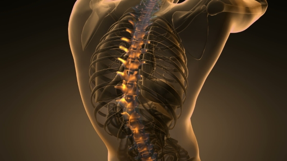 Backache in Back Bones - Download Videohive 20567311