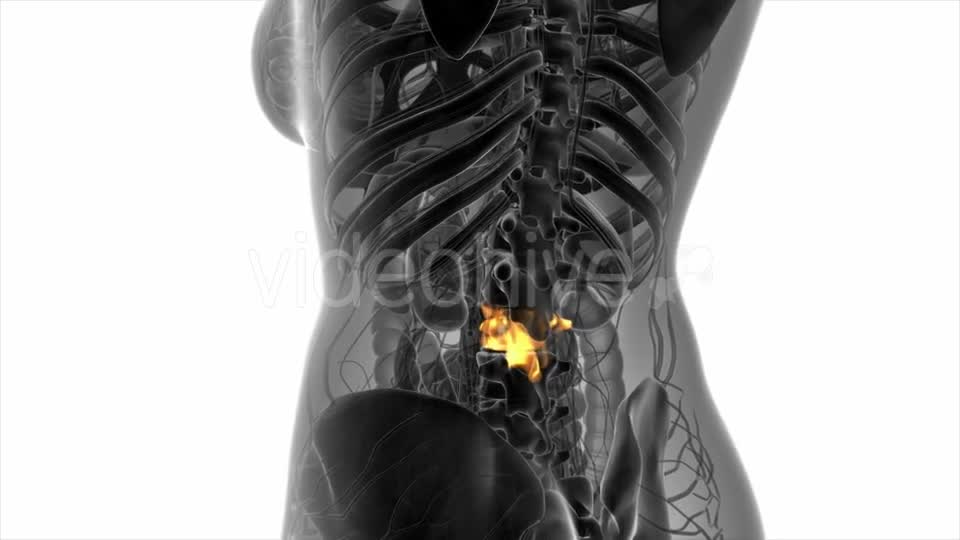 Backache in Back Bones - Download Videohive 20568916