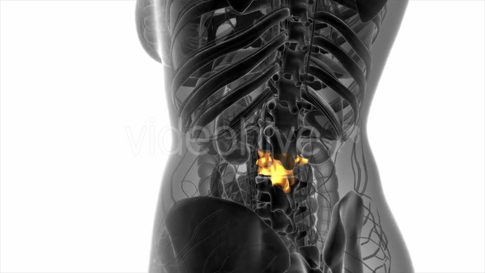 Backache in Back Bones - Download Videohive 20568916