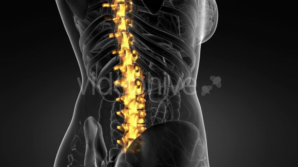 Backache in Back Bones - Download Videohive 20624958