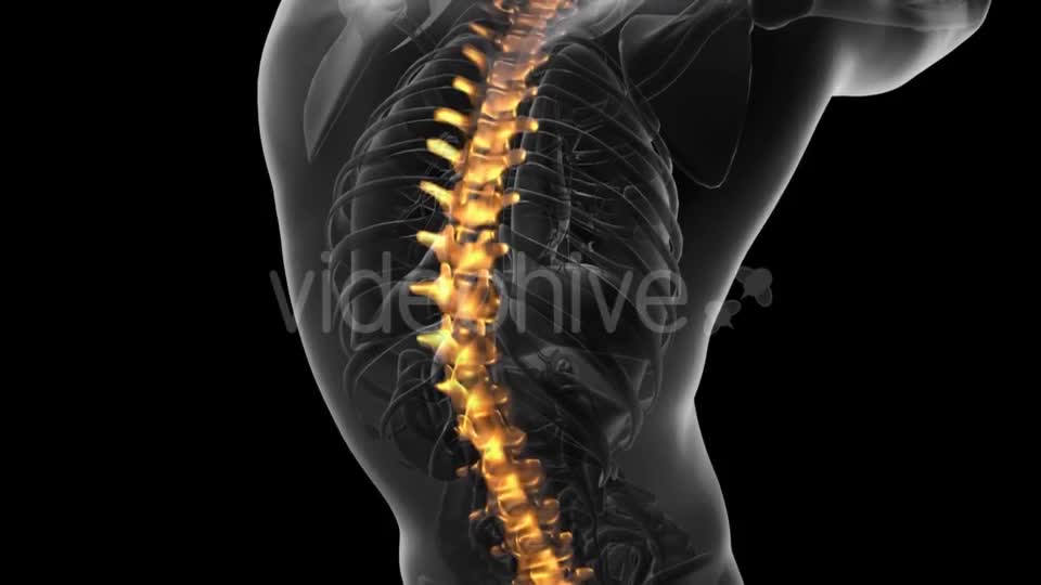 Backache in Back Bones - Download Videohive 20734237