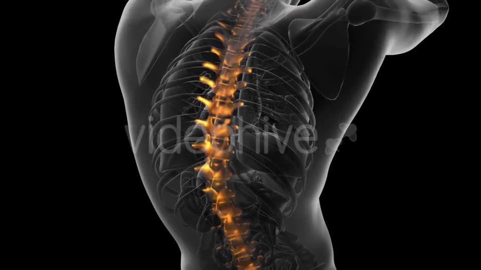 Backache in Back Bones - Download Videohive 20734237