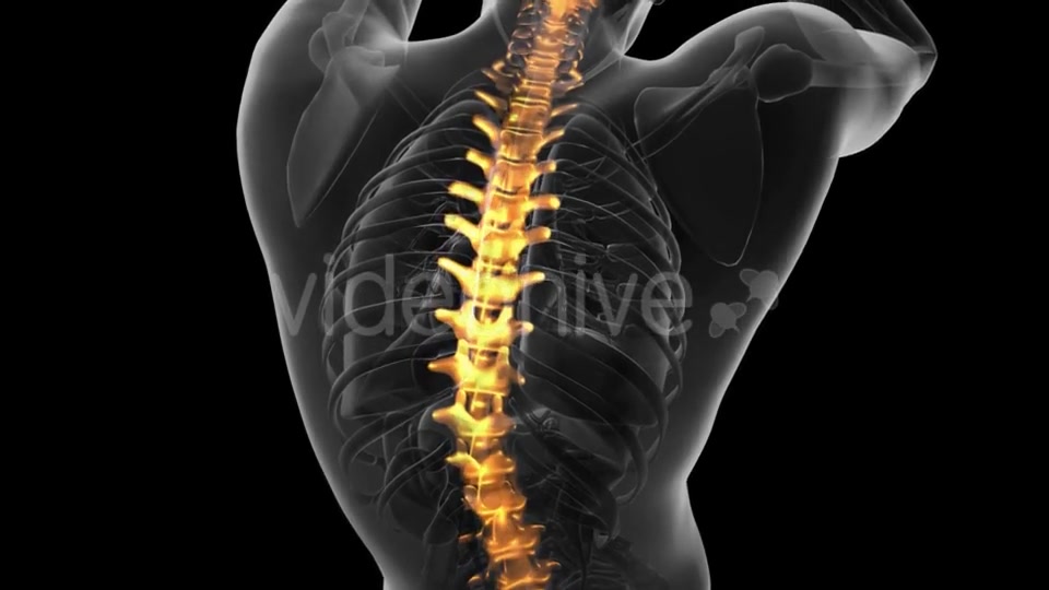 Backache in Back Bones - Download Videohive 20734237