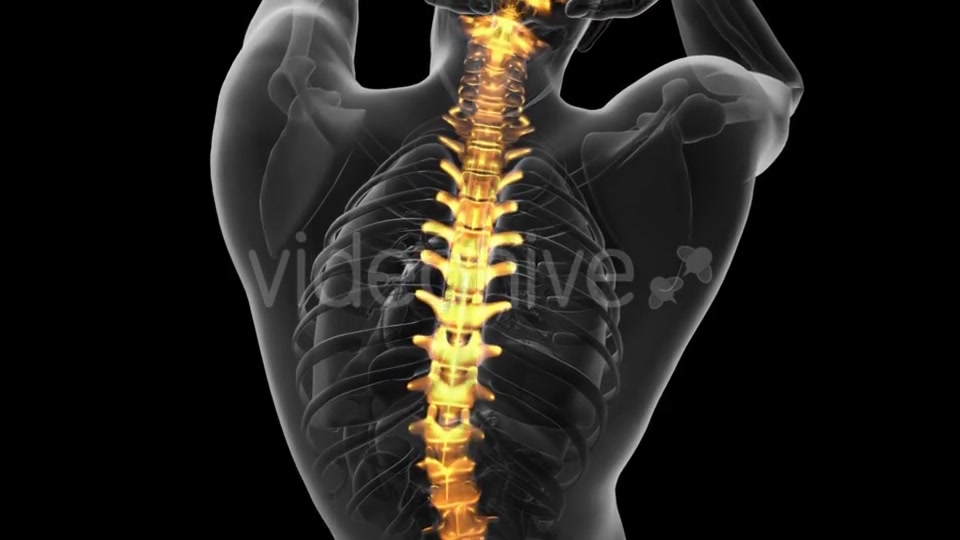 Backache in Back Bones - Download Videohive 20734237