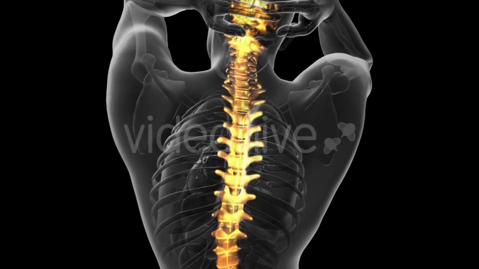 Backache in Back Bones - Download Videohive 20734237