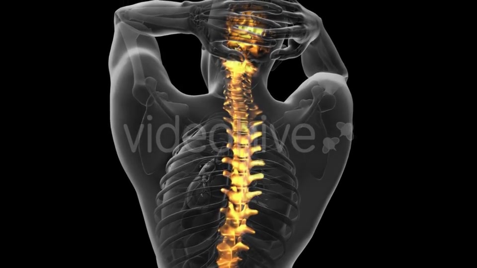 Backache in Back Bones - Download Videohive 20734237