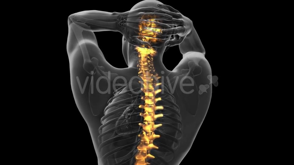 Backache in Back Bones - Download Videohive 20734237