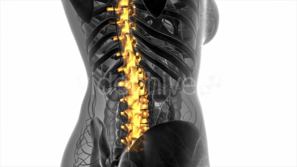 Backache in Back Bones - Download Videohive 20778095