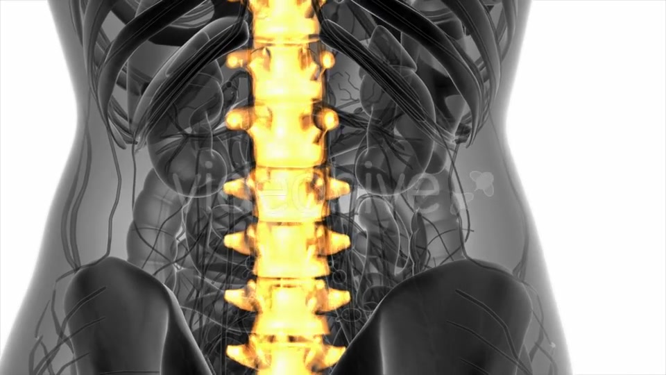 Backache in Back Bones - Download Videohive 20778095