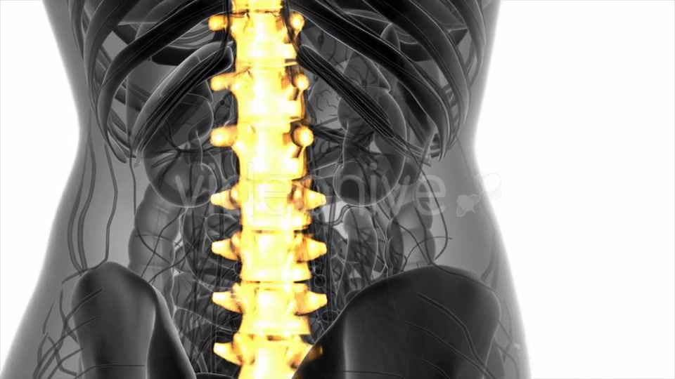 Backache in Back Bones - Download Videohive 20778095