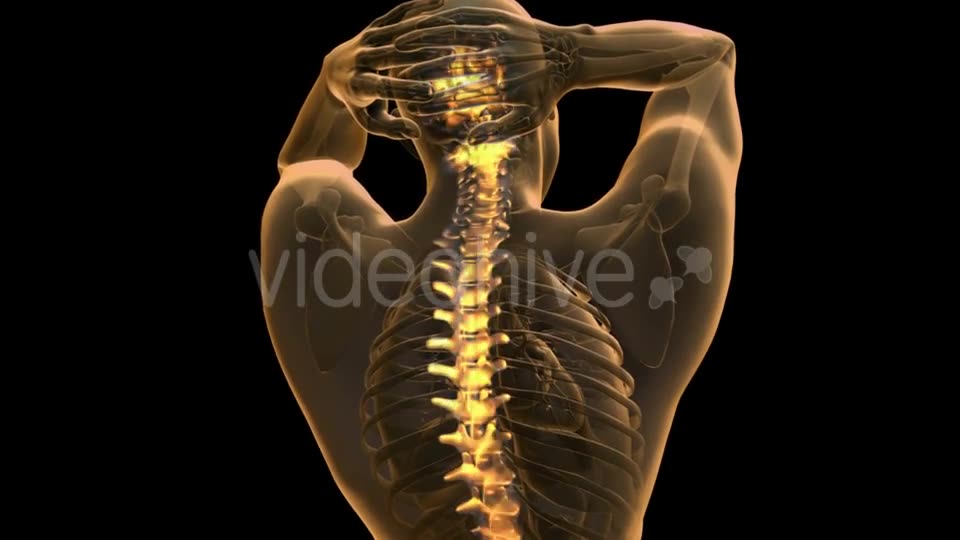 Backache in Back Bones - Download Videohive 20778175