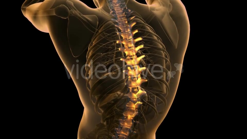 Backache in Back Bones - Download Videohive 20778175