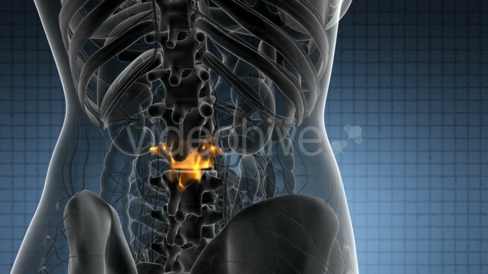 Backache in Back Bones - Download Videohive 20823629