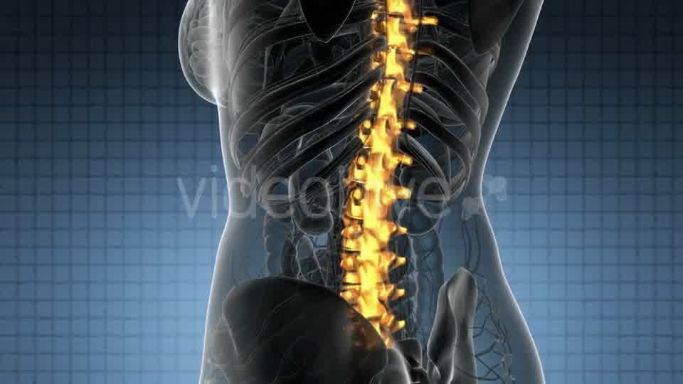 Backache in Back Bones - Download Videohive 20824333