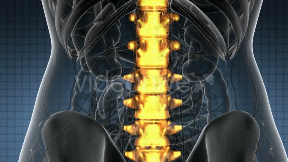 Backache in Back Bones - Download Videohive 20824333