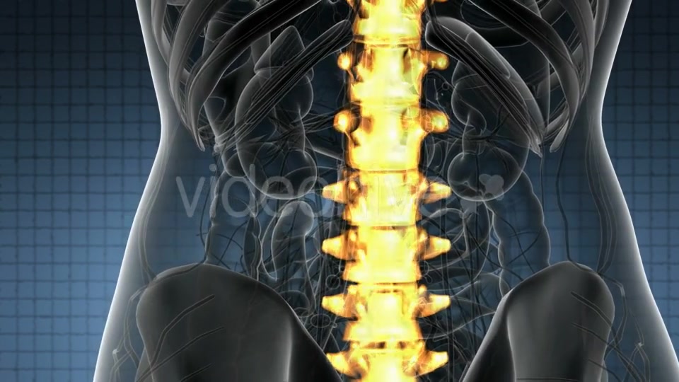 Backache in Back Bones - Download Videohive 20824333