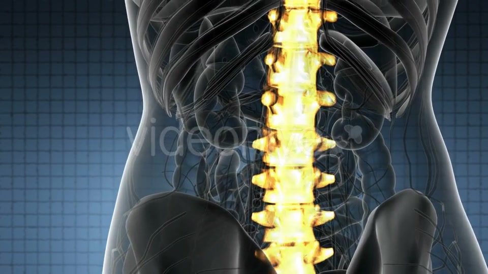 Backache in Back Bones - Download Videohive 20824333