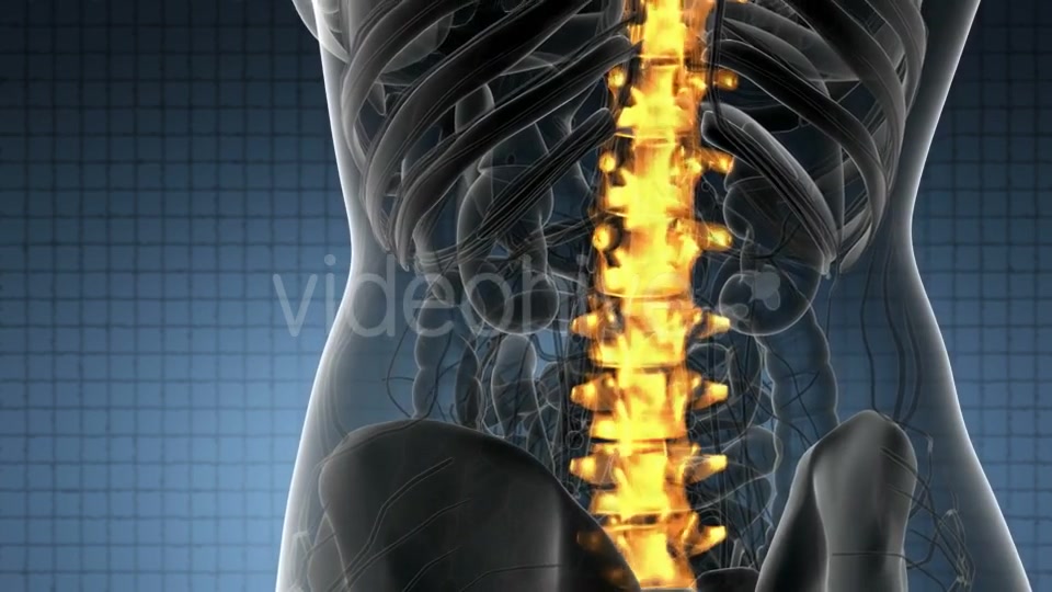 Backache in Back Bones - Download Videohive 20824333