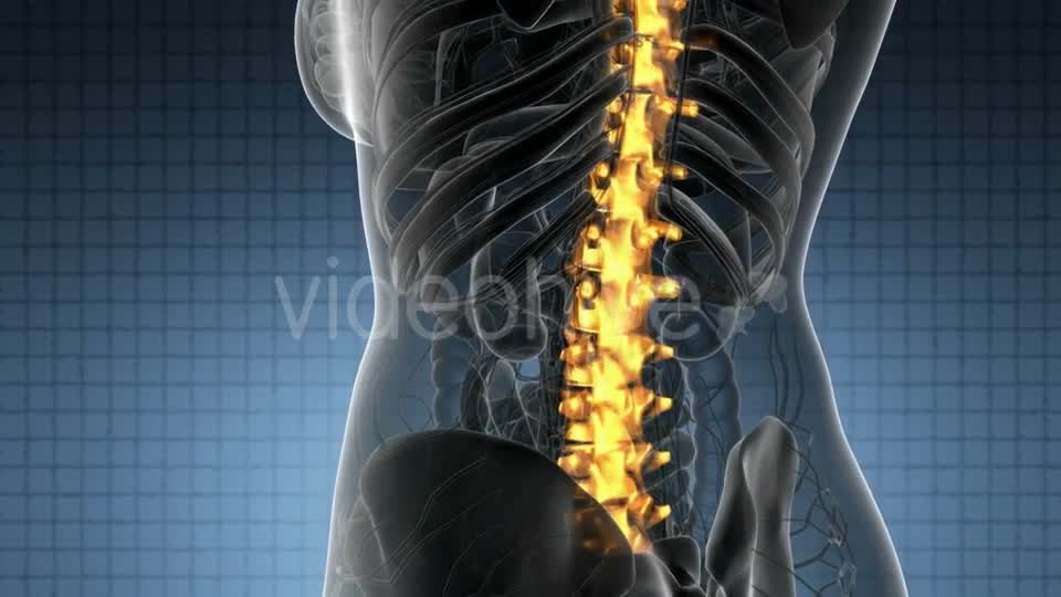 Backache in Back Bones - Download Videohive 20824333