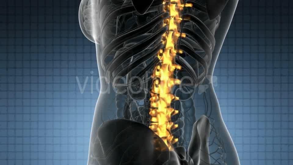 Backache in Back Bones - Download Videohive 20824333