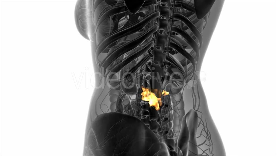 Backache in Back Bones - Download Videohive 20824335