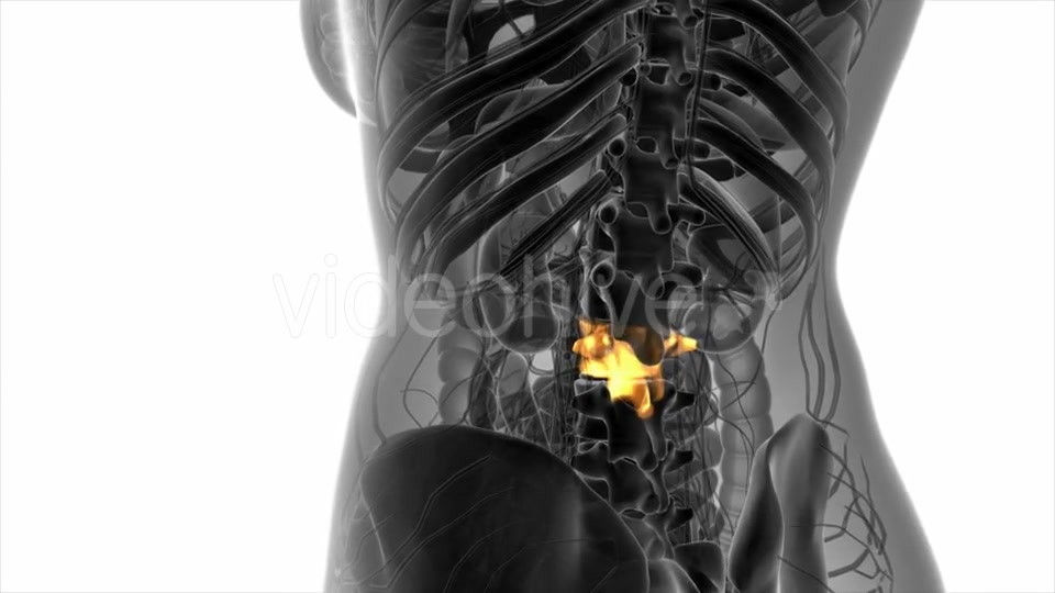 Backache in Back Bones - Download Videohive 20824335