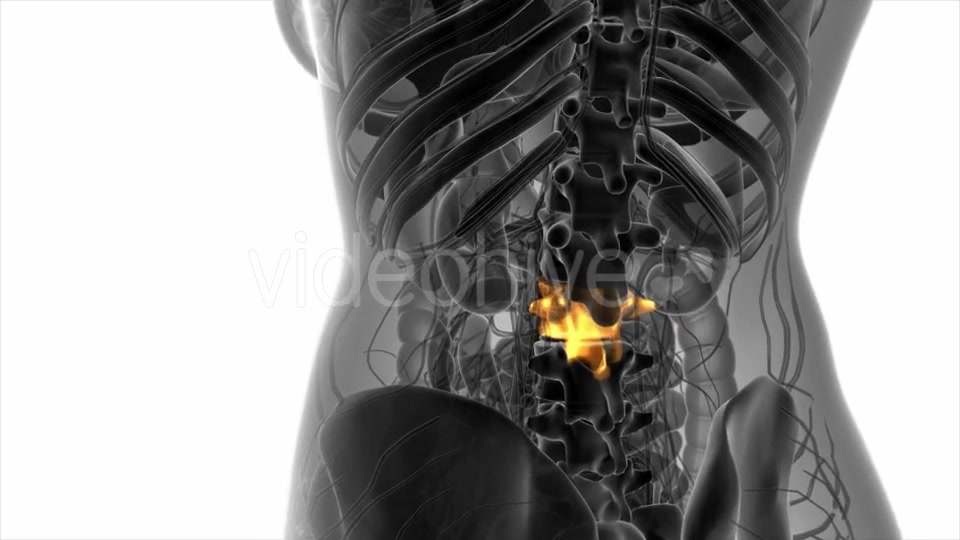 Backache in Back Bones - Download Videohive 20824335