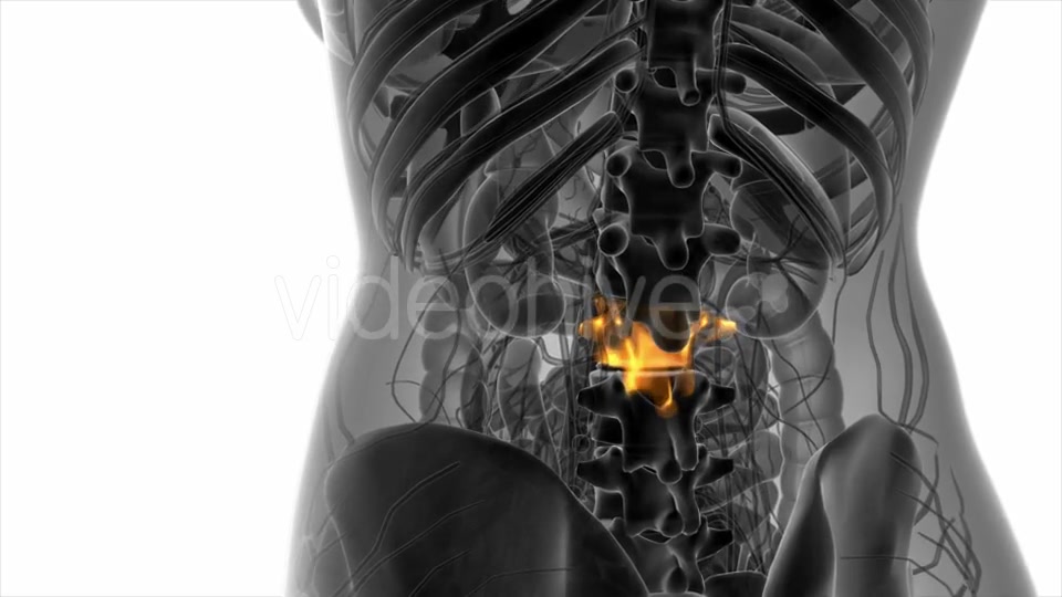 Backache in Back Bones - Download Videohive 20824335