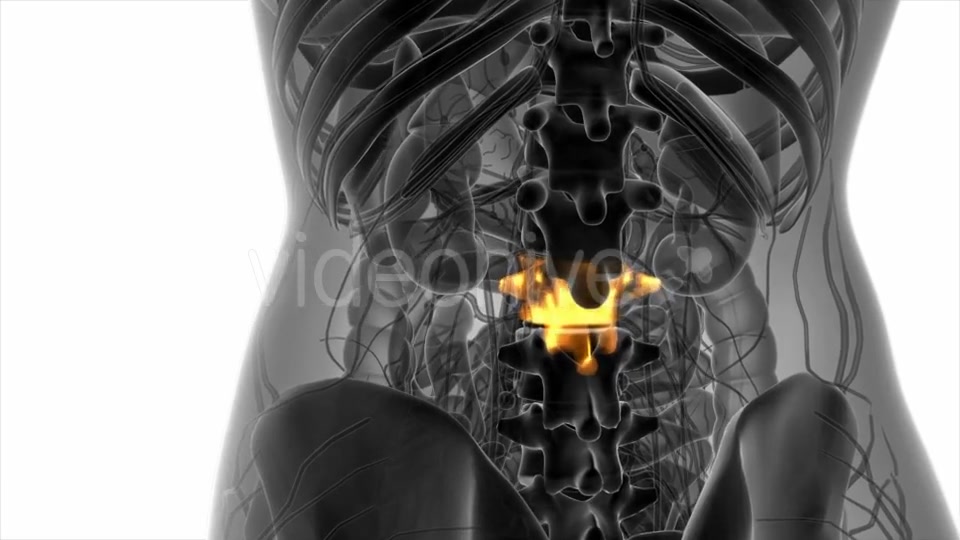 Backache in Back Bones - Download Videohive 20824335