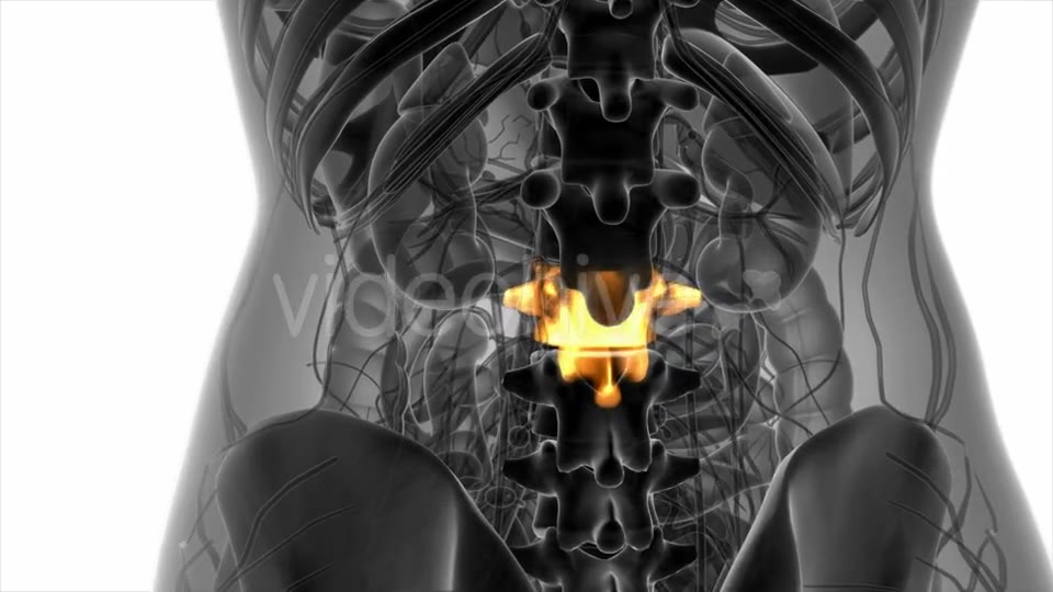 Backache in Back Bones - Download Videohive 20824335