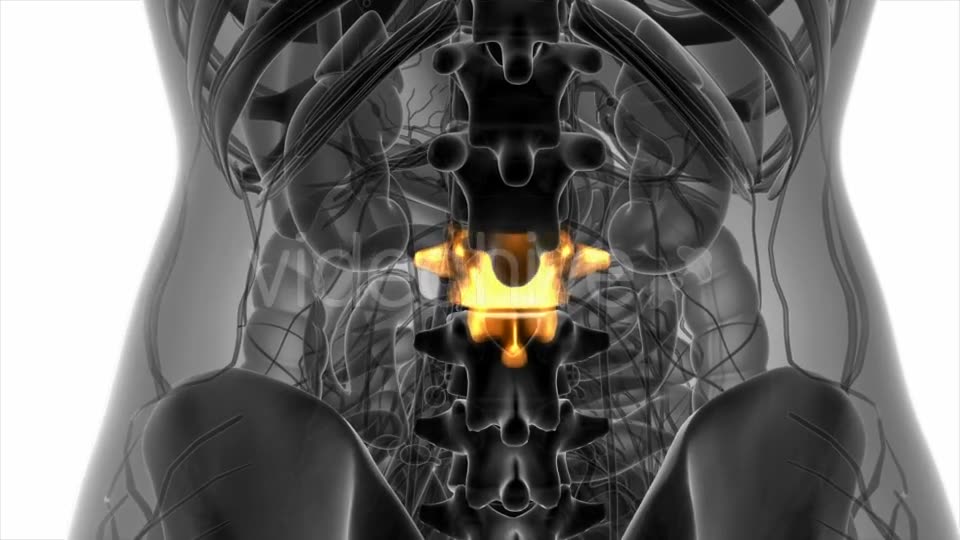 Backache in Back Bones - Download Videohive 20824335