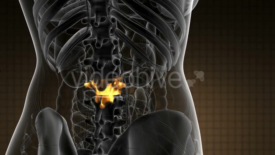 Backache in Back Bones - Download Videohive 20856791