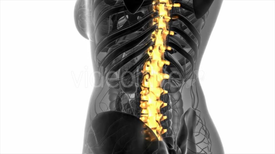 Backache in Back Bones - Download Videohive 20856952