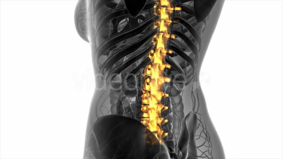 Backache in Back Bones - Download Videohive 20945429