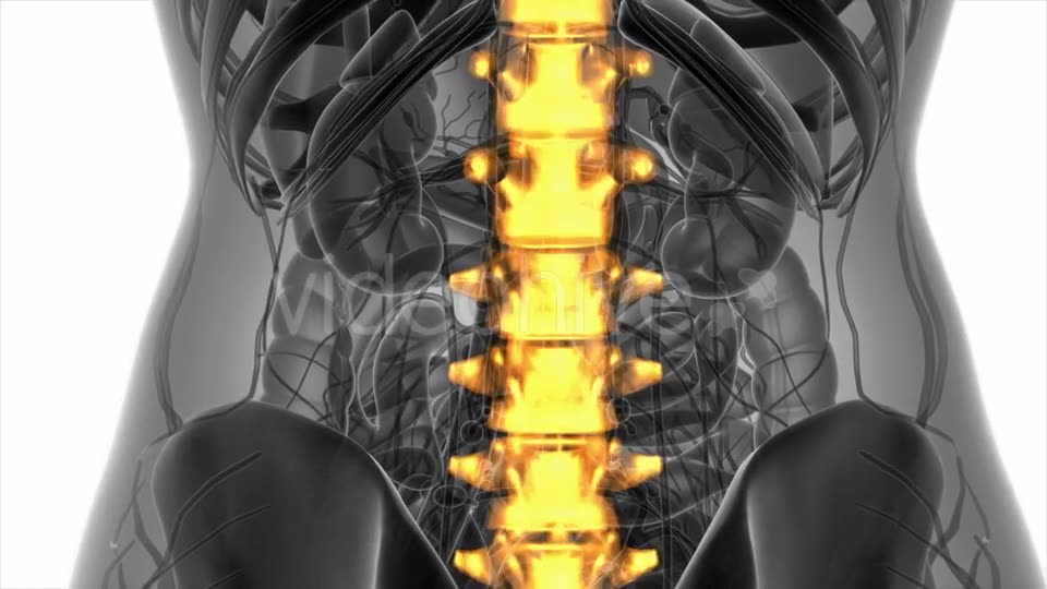 Backache in Back Bones - Download Videohive 20945429