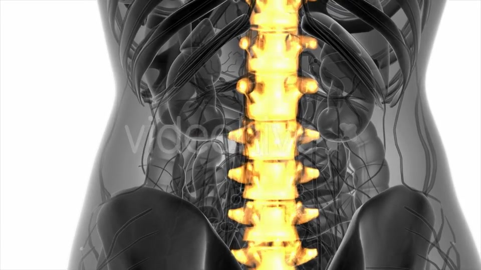 Backache in Back Bones - Download Videohive 20945429