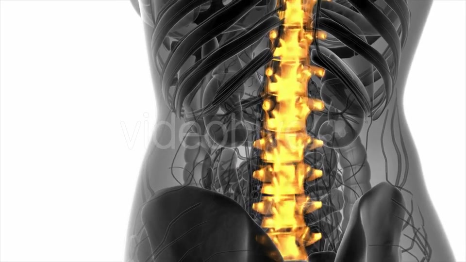 Backache in Back Bones - Download Videohive 20945429
