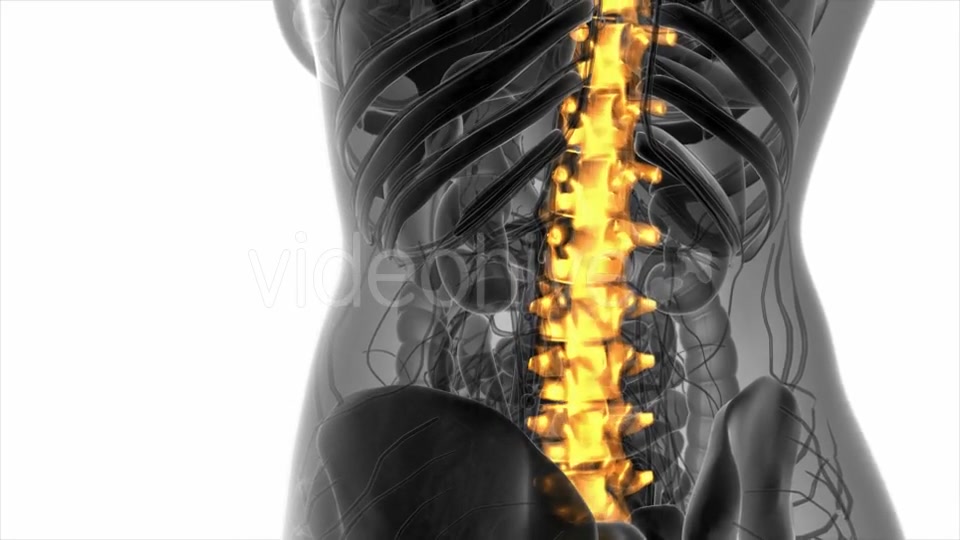 Backache in Back Bones - Download Videohive 20945429