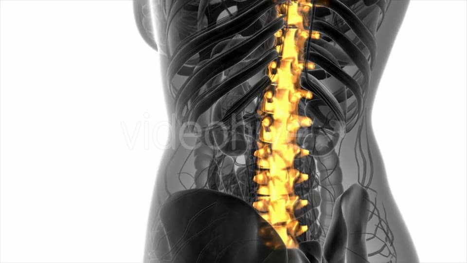 Backache in Back Bones - Download Videohive 20945429