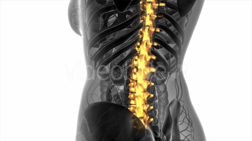 Backache in Back Bones - Download Videohive 20945429