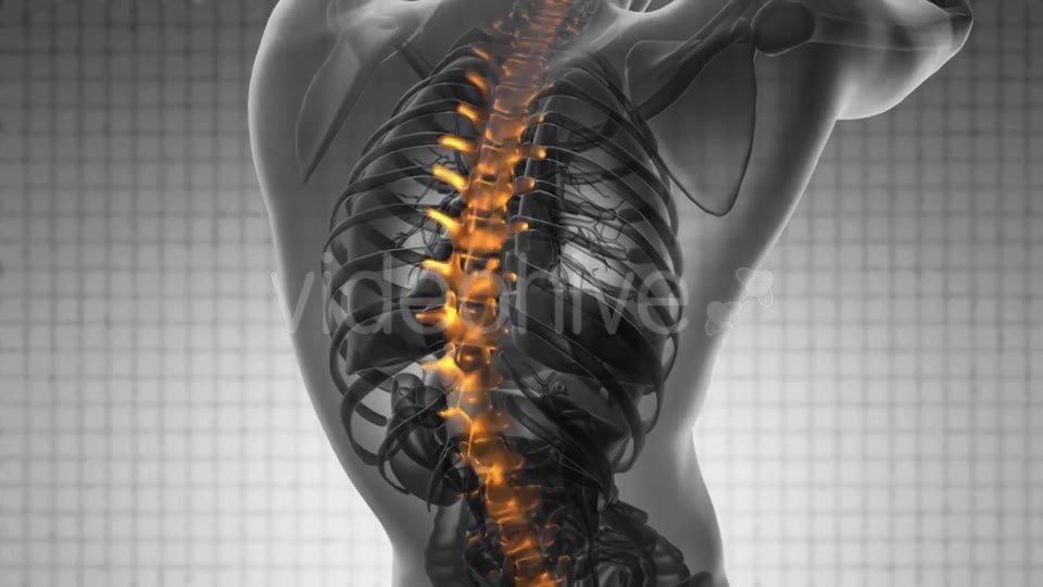 Backache in Back Bones - Download Videohive 21020684