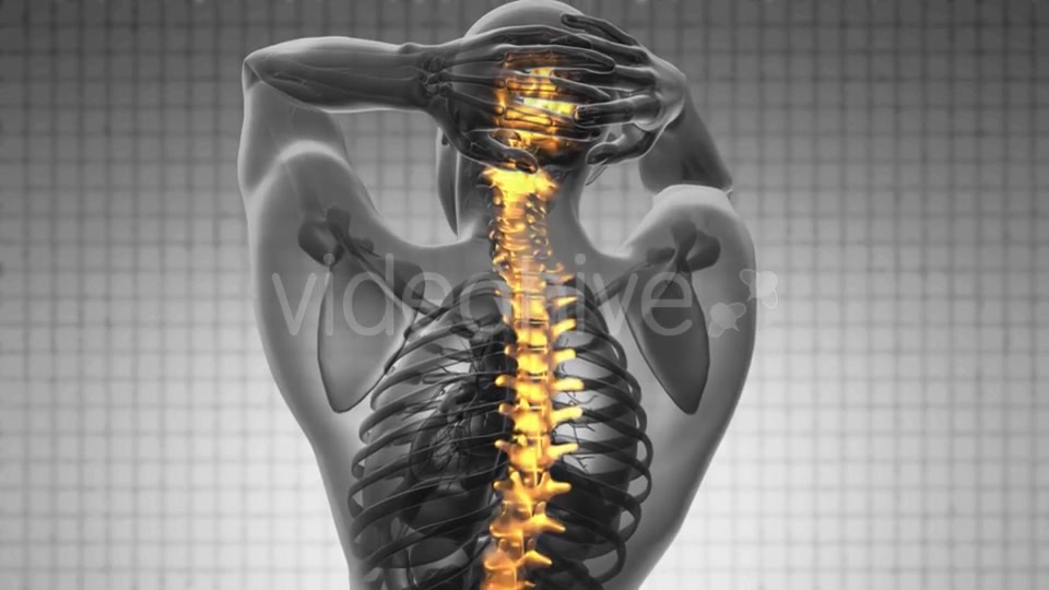 Backache in Back Bones - Download Videohive 21020684