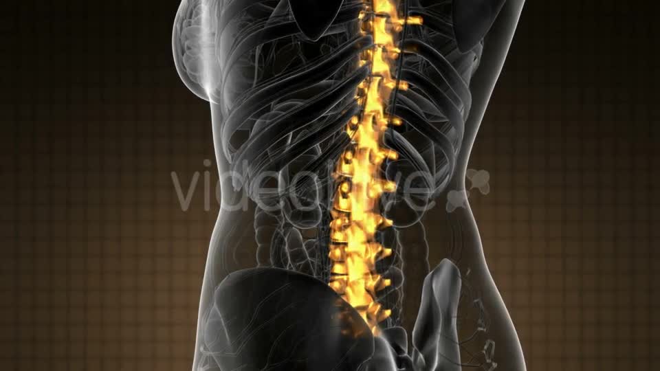 Backache in Back Bones - Download Videohive 21020704