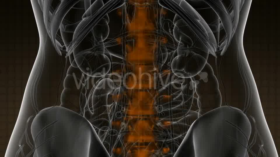 Backache in Back Bones - Download Videohive 21020704